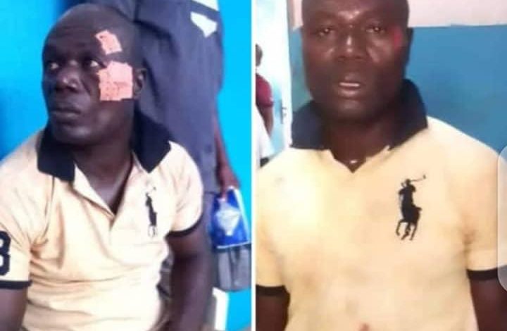 Photo of Gboguhé : des précisions sur l’agression présumée à un meeting du Ppa-CI d’un militant du Fpi