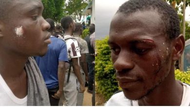 Photo of Des étudiants blessés à Nangui Abrogoua – Accusée par l’Aeemci, la Fesci dément